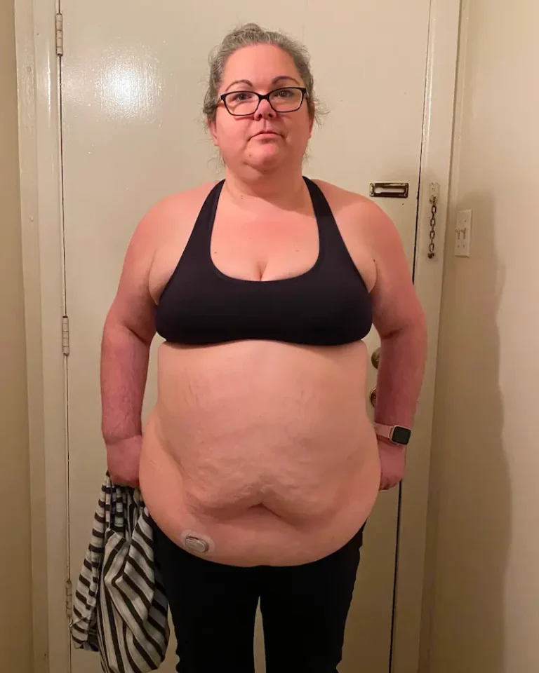 Jill Before BMI of Texas