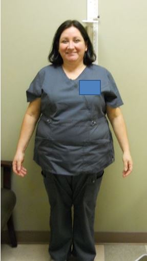Women S Weight Loss Surgery Success Stories Bmi Of Texas