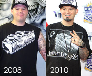 Image of Paul Wall after bariatric weight loss surgery
