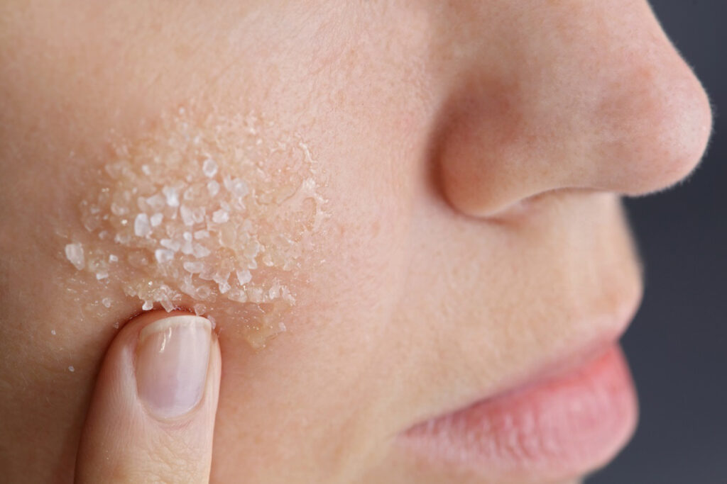 Close up of woman putting exfoliant on her cheek to follow summer skin care tips.